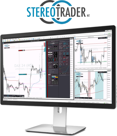 stereo-trader-image